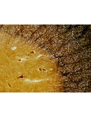 Coffret de lames préparées pour microscope